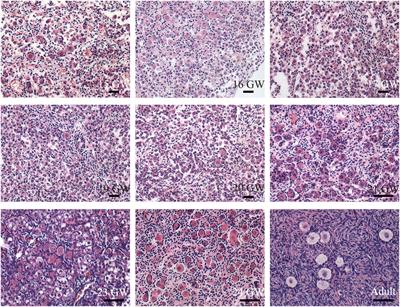 The dynamic expression of SOX17 in germ cells from human female foetus and adult ovaries after specification
